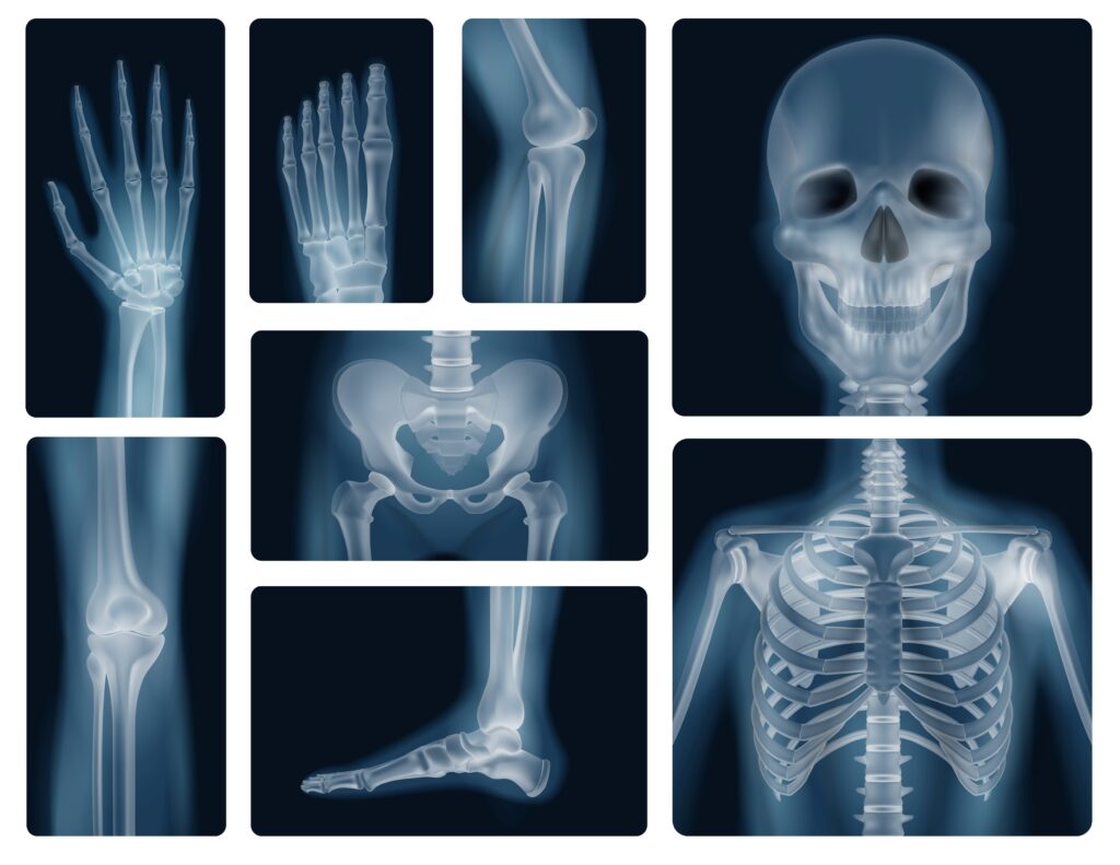 Densitometria e valutazione dell'osteoporosi